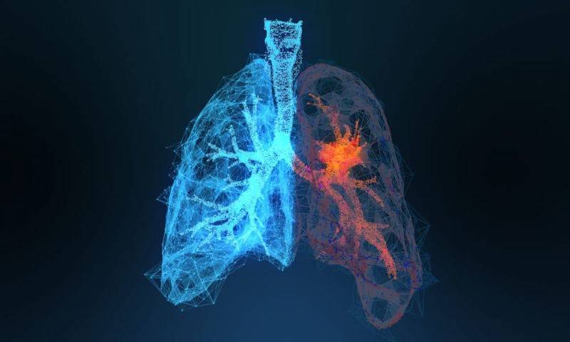 Qureight tech deployed in lung fibrosis clinical trial