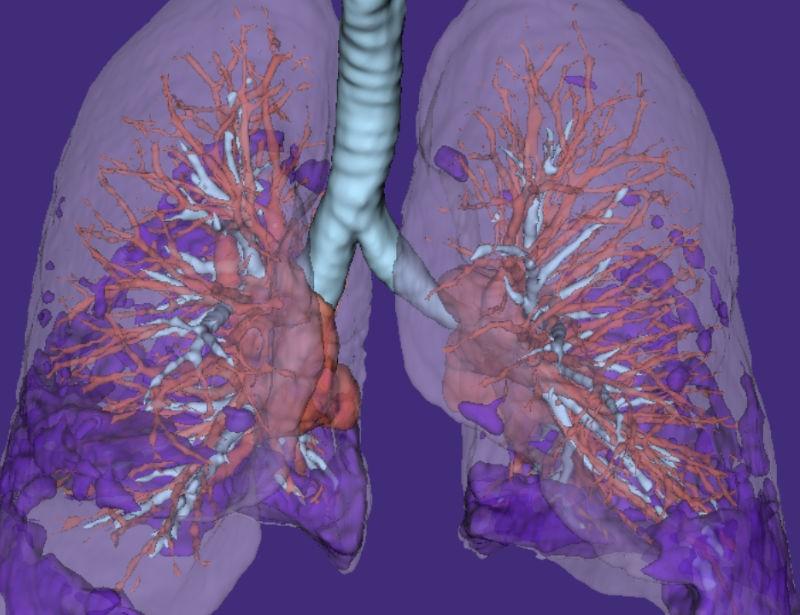 AI-powered endpoints and analytics