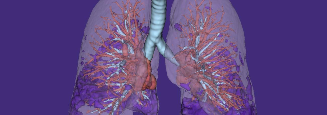 AI-powered endpoints and analytics