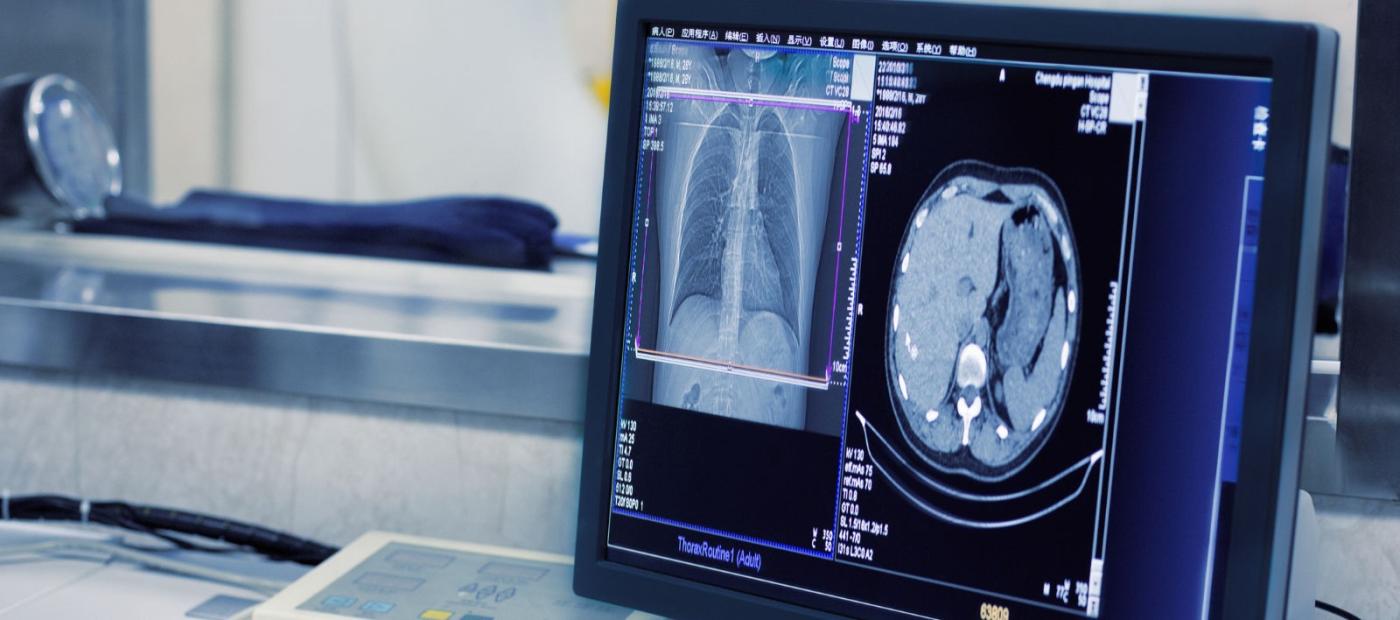 Global imaging CRO services